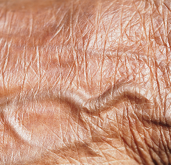 Fructose and skin