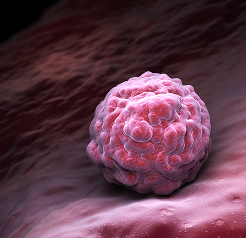 Fructose and Chronic Diseases